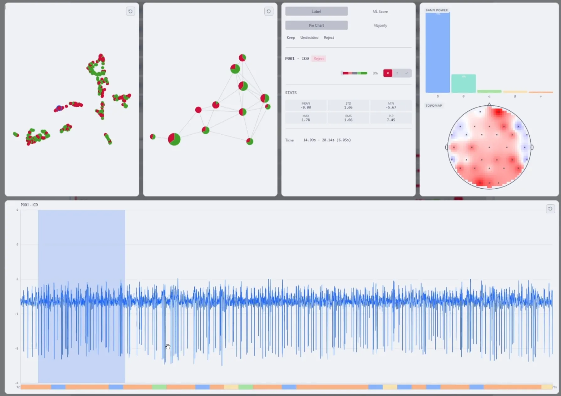 Visual Inspection of EEG Data Frame and Model