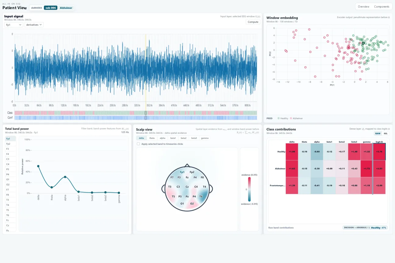 XEEG Model Dashboard